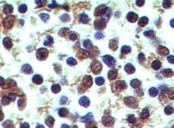 Dectin-2/CLEC6A Antibody (3D1) - BSA Free, Novus Biologicals 0.025mg; Unlabeled:Antibodies,