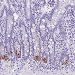 Defensin alpha 5 Antibody, Novus Biologicals 0.1mL; Unlabeled:Antibodies
