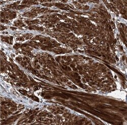 Deoxyguanosine kinase Antibody, Novus Biologicals 0.1mL; Unlabeled:Antibodies,