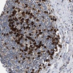 Derlin 1 Antibody, Novus Biologicals:Antibodies:Primary Antibodies