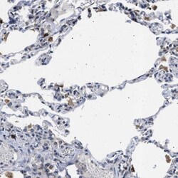 Derlin 1 Antibody, Novus Biologicals:Antibodies:Primary Antibodies