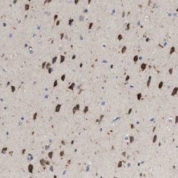 Derlin 1 Antibody, Novus Biologicals:Antibodies:Primary Antibodies