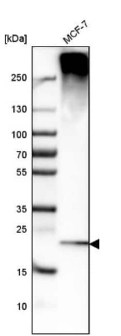 Derlin 1 Antibody, Novus Biologicals:Antibodies:Primary Antibodies