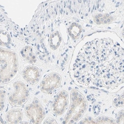 Desmocollin-2 Antibody, Novus Biologicals:Antibodies:Primary Antibodies