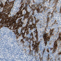 Desmocollin-2 Antibody, Novus Biologicals:Antibodies:Primary Antibodies