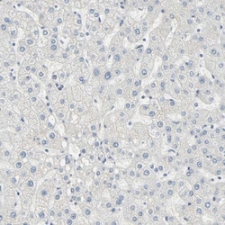 Desmoglein-2 Antibody, Novus Biologicals:Antibodies:Primary Antibodies