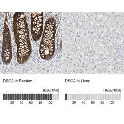 Desmoglein-2 Antibody, Novus Biologicals:Antibodies:Primary Antibodies