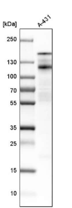Desmoglein-2 Antibody, Novus Biologicals:Antibodies:Primary Antibodies