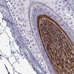 Desmoglein-4 Antibody, Novus Biologicals:Antibodies:Primary Antibodies