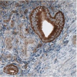 Dicer Antibody (CL0378), Novus Biologicals:Antibodies:Primary Antibodies