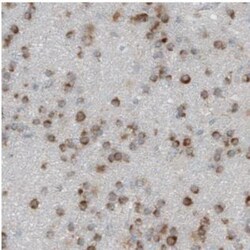 Dicer Antibody (CL0378), Novus Biologicals:Antibodies:Primary Antibodies