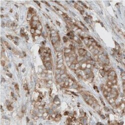 Dicer Antibody (CL0378), Novus Biologicals:Antibodies:Primary Antibodies