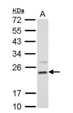 Dihydrofolate Reductase/DHFR Antibody, Novus Biologicals 0.1mL; Unlabeled:Antikroppar