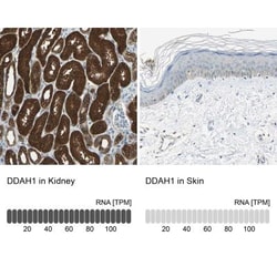 Dimethylarginine Dimethylaminohydrolase 1/DDAH1 Antibody, Novus Biologicals