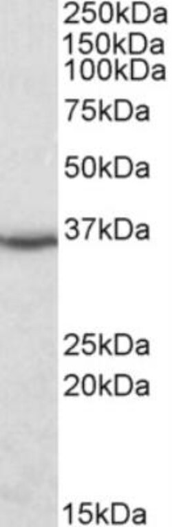 Dimethylarginine Dimethylaminohydrolase 1/DDAH1 Antibody, Novus Biologicals