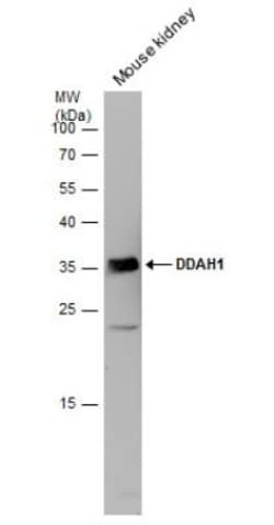 Dimethylarginine Dimethylaminohydrolase 1/DDAH1 Antibody, Novus Biologicals