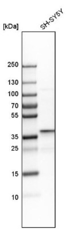 Dimethylarginine Dimethylaminohydrolase 1/DDAH1 Antibody, Novus Biologicals