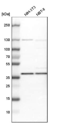 Dimethylarginine Dimethylaminohydrolase 1/DDAH1 Antibody, Novus Biologicals