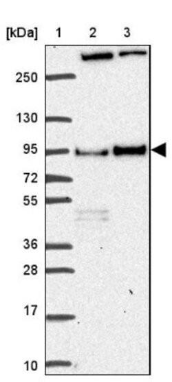 Dishevelled-3 Antibody, Novus Biologicals 25 &mu;L | Buy Online | Novus Biologicals | Fisher Scientific
