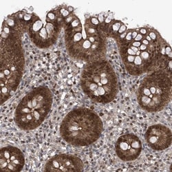 DjC9 Antibody, Novus Biologicals 0.1mL; Unlabeled:Antibodies, Polyclonal
