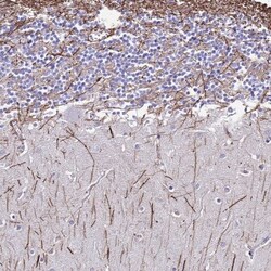 Dlx1 Antibody, Novus Biologicals 25 &mu;L, Unconjugated:Antibodies, Polyclonal