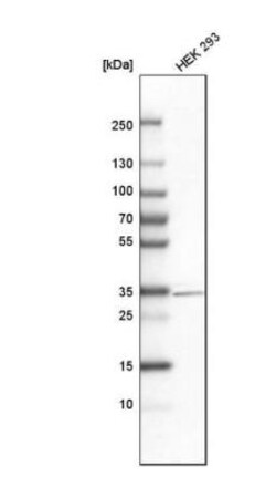 Dlx1 Antibody, Novus Biologicals:Antibodies:Primary Antibodies