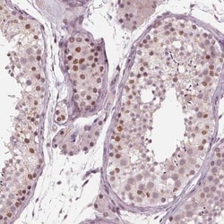 Dnmt3L Antibody, Novus Biologicals 25 &mu;L, Unlabeled:Antibodies, Polyclonal