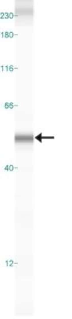 Dopa Decarboxylase/DDC Antibody, Novus Biologicals 0.02mL:Antibodies, Polyclonal