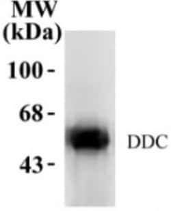 Dopa Decarboxylase/DDC Antibody, Novus Biologicals 0.02mL:Antibodies, Polyclonal