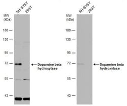 Dopamine beta-Hydroxylase Antibody, Novus Biologicals 0.1mg; Unlabeled:Antibodies,