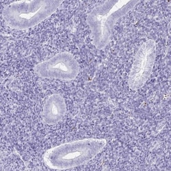 Doppel Antibody, Novus Biologicals 0.1mL; Unlabeled:Antibodies, Polyclonal