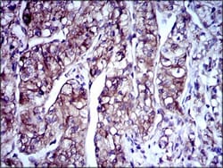 Doublecortin Antibody (2G5) - BSA Free, Novus Biologicals:Antibodies:Primary