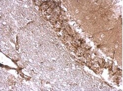 Drebrin 1 Antibody, Novus Biologicals 0.1 mL | Buy Online | Novus Biologicals | Fisher Scientific