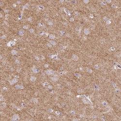 Drebrin 1 Antibody, Novus Biologicals 25 &mu;L, Unlabeled:Antibodies, Polyclonal