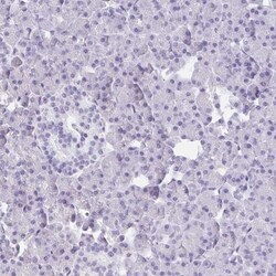 Drebrin 1 Antibody, Novus Biologicals 25 &mu;L, Unlabeled:Antibodies, Polyclonal