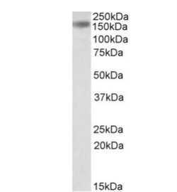 Drosha Antibody, Novus Biologicals 0.1mg; Unlabeled:Antibodies, Polyclonal