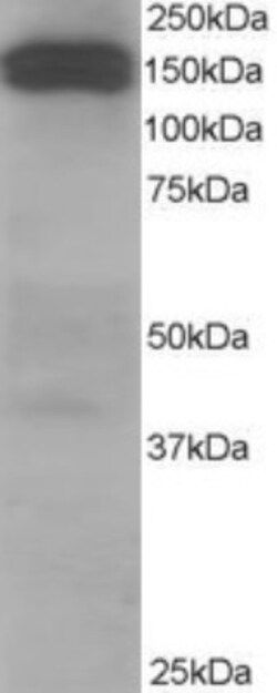 Dynactin Subunit 1/DCTN1 Antibody, Novus Biologicals 0.1 mg | Buy Online | Novus Biologicals | Fisher Scientific
