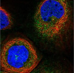 Dynactin Subunit 2/DCTN2/DCTN-50 Antibody, Novus Biologicals 0.1mL; Unlabeled:Antibodies,