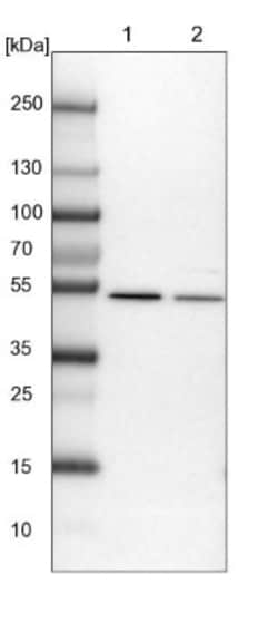 Dynactin Subunit 2/DCTN2/DCTN-50 Antibody, Novus Biologicals 0.1mL; Unlabeled:Antibodies,