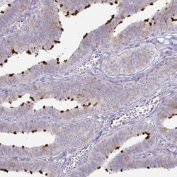 Dynein heavy chain Antibody, Novus Biologicals 0.1mL; Unlabeled:Antibodies,