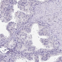 Dynein heavy chain Antibody, Novus Biologicals 0.1mL; Unlabeled:Antibodies,
