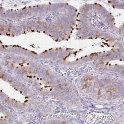 Dynein intermediate chain 2 Antibody, Novus Biologicals 0.1mL; Unlabeled:Antibodies,
