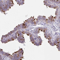 Dynein intermediate chain 2 Antibody, Novus Biologicals 0.1mL; Unlabeled:Antibodies,