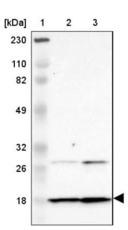 Dynein light chain 4 Antibody, Novus Biologicals 25 &mu;L; Unlabeled:Antibodies,