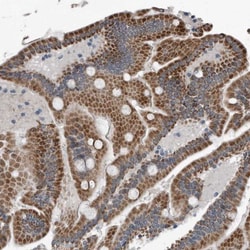 Dystonin Antibody, Novus Biologicals 25 &mu;L; Unlabeled:Antibodies, Polyclonal