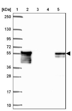 Dystrobrevin beta Antibody, Novus Biologicals 25 &mu;L, Unlabeled:Antibodies,