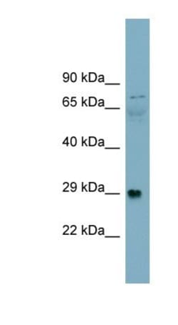 Alpha Dystroglycan Antibody, Novus Biologicals 0.05mg; Unlabeled:Antibodies,