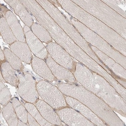 Dystrophin Antibody, Novus Biologicals 0.1mL; Unlabeled:Antibodies, Polyclonal