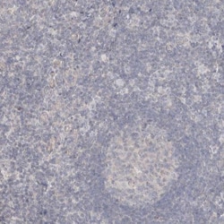Dystrophin Antibody, Novus Biologicals 0.1mL; Unlabeled:Antibodies, Polyclonal