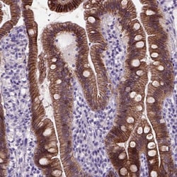 E-Cadherin Antibody (CL1170), Novus Biologicals 0.1mL; Unlabeled:Antibodies,